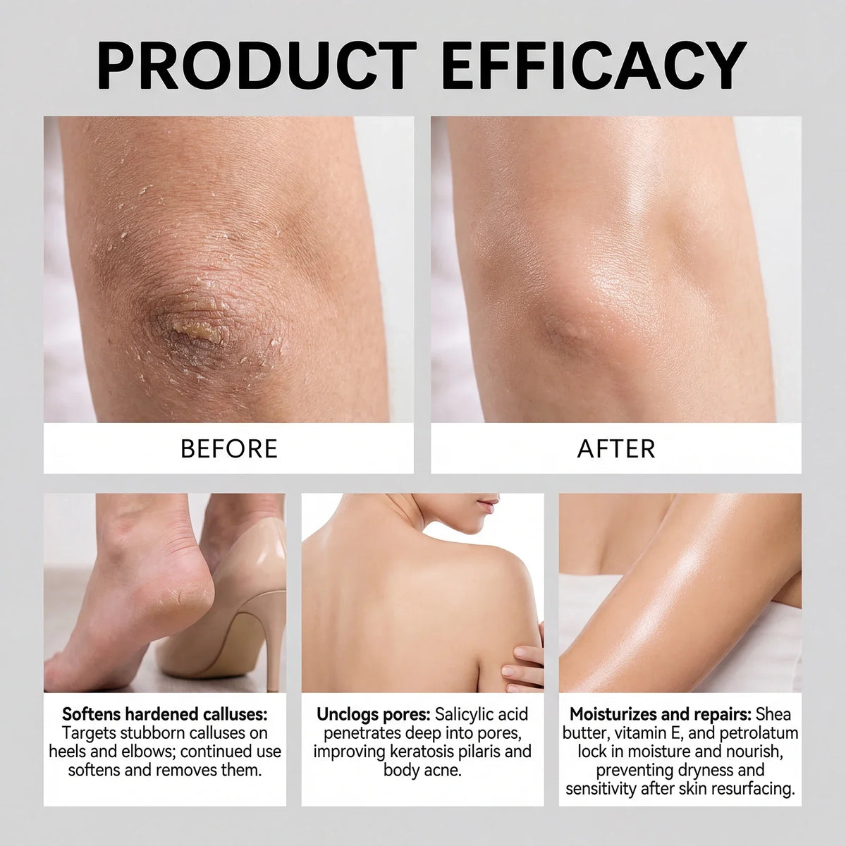 AHA BHA Exfoliating Body Stick with Shea Butter | Qme Body Exfoliating Stick Qme