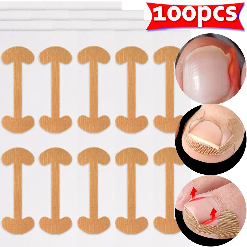 Waterproof Toenail Correction Strips | Lasting Adhesion Nail Correction Strips Qme