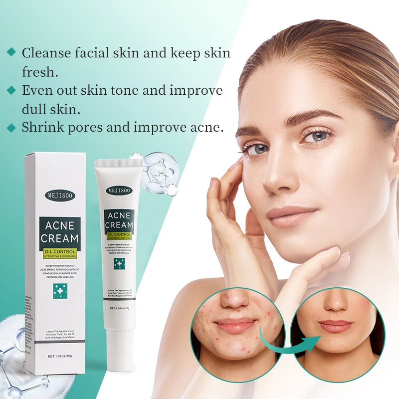 Salicylic Acid Face Cream – Pore Minimizing & Oil Control 30g Salicylic Acid Cream Qst
