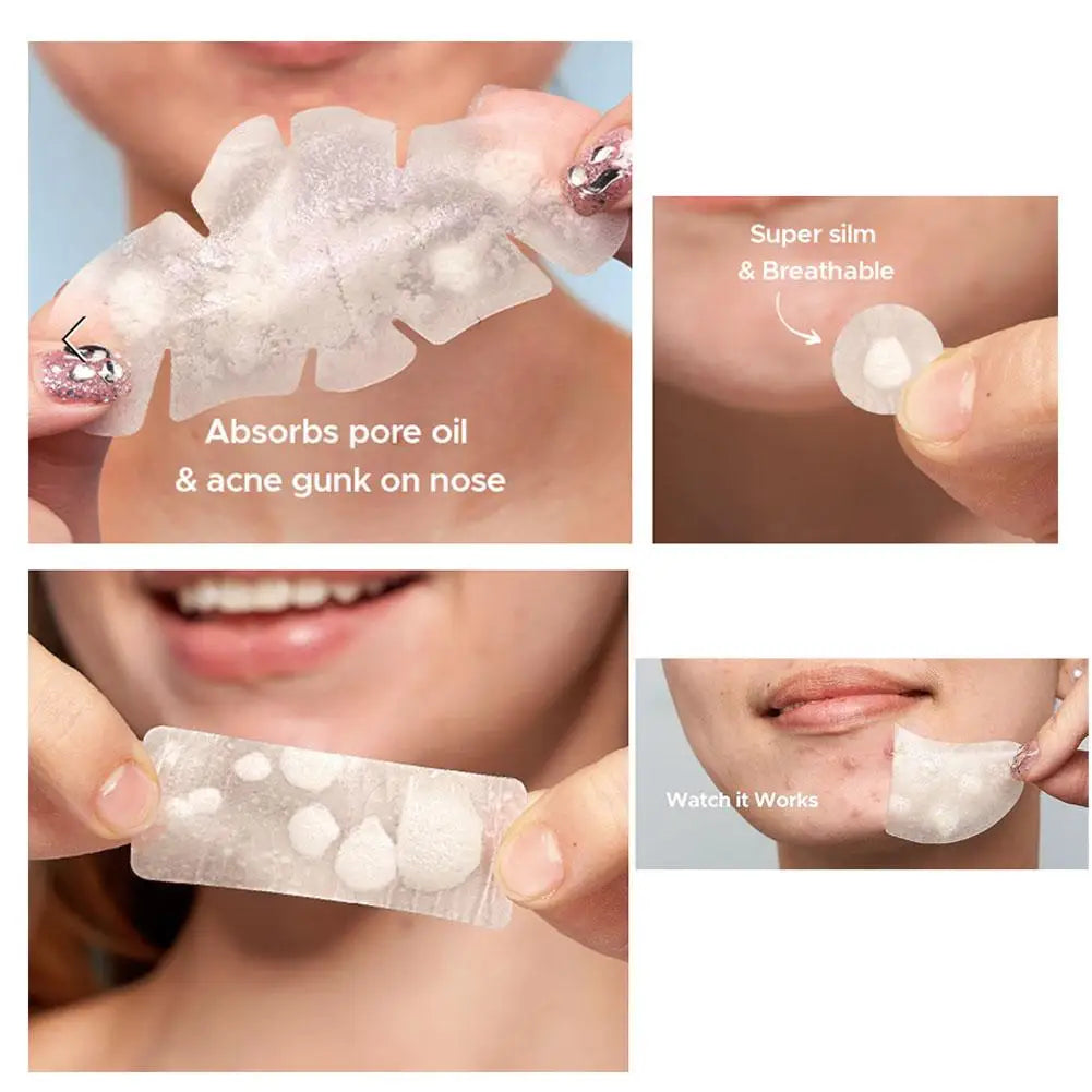 Hydrocolloid Pimple Patches Bulk – 5 Sizes for Face & Body Acne Pimple Patches Qme