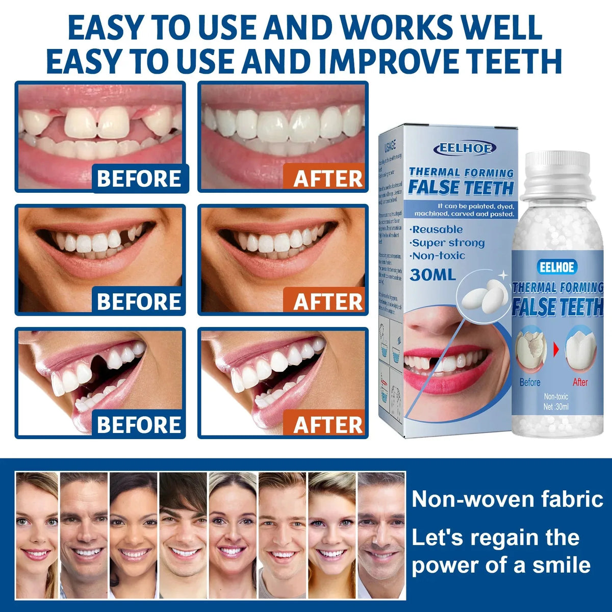 30ml Moldable Temporary Tooth Repair Granules – Dental Kit Dental Repair Kit Qst