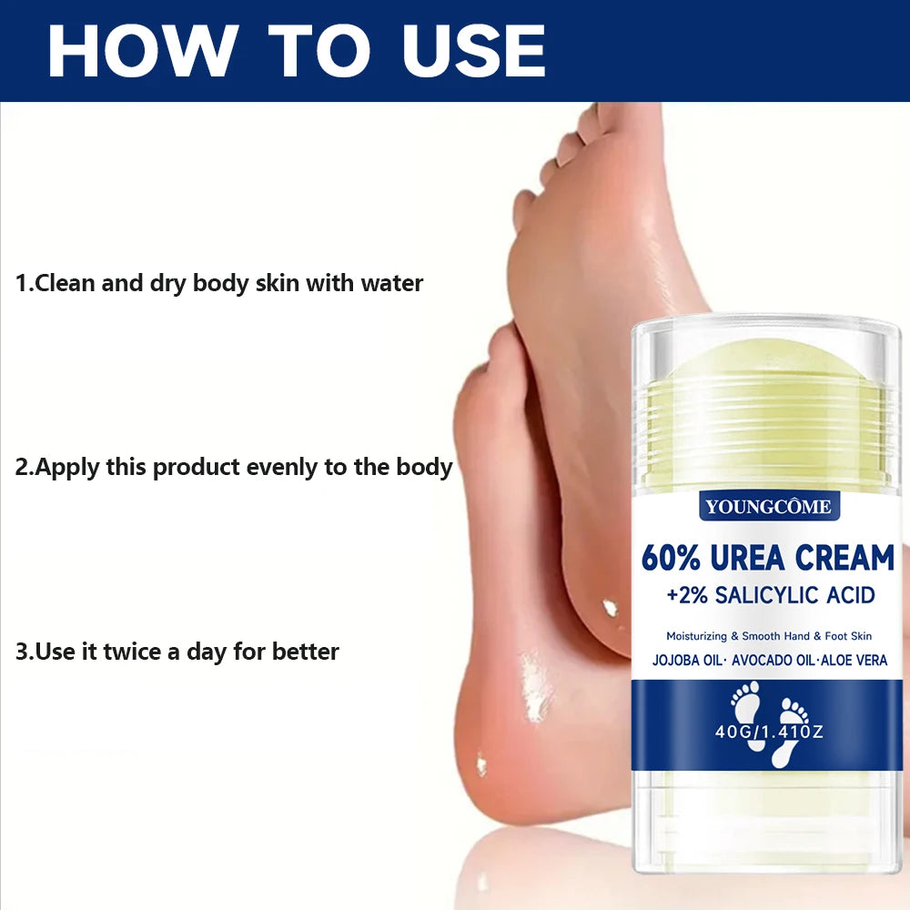 YOUNGCOME 60% Urea Foot Cream – Deep Hydration & Exfoliation Foot Cream Qst