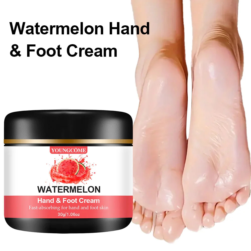YOUNGCOME Foot Cream – Moisturizing, Exfoliating & Heel Repair Foot Care Cream Qst