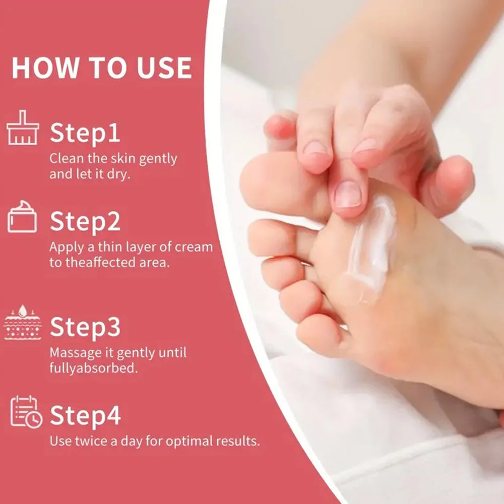 YOUNGCOME 42% Urea Strawberry Hand & Foot Cream 30g/60g Hand & Foot Cream Qst