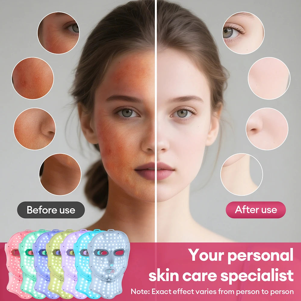 Wireless 7-Color LED Face & Neck Mask – Photon Skin Care LED Skin Care Mask Qst