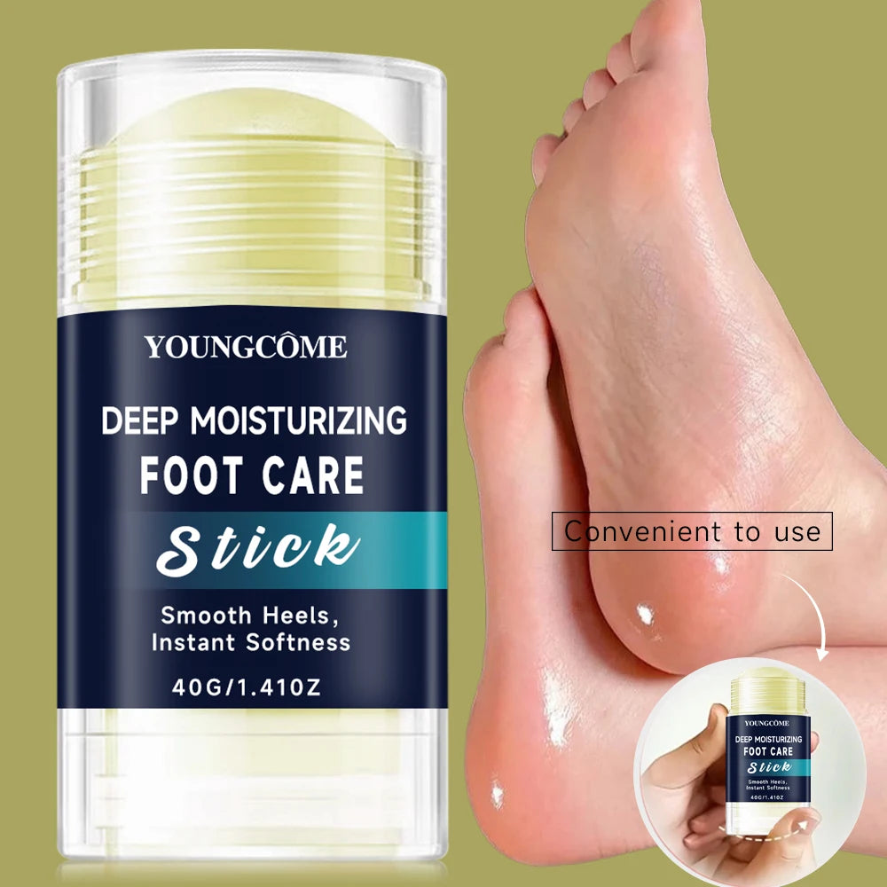 YOUNGCOME Deep Moisturizing Foot Cream – Nourishing & Smoothing Foot Care Cream Qst