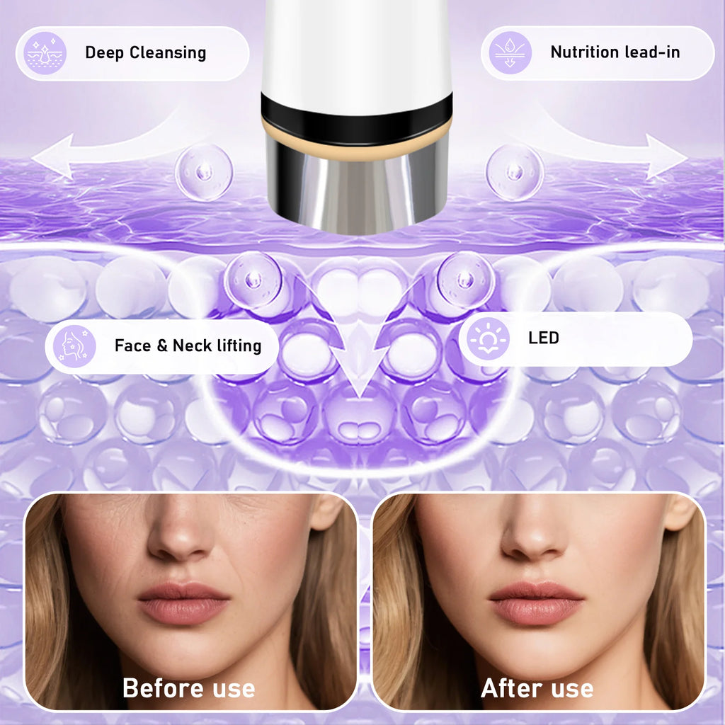 VIMYSHOW 4-Mode Microcurrent Facial Massager & Firming Device Facial Massager Device Qst