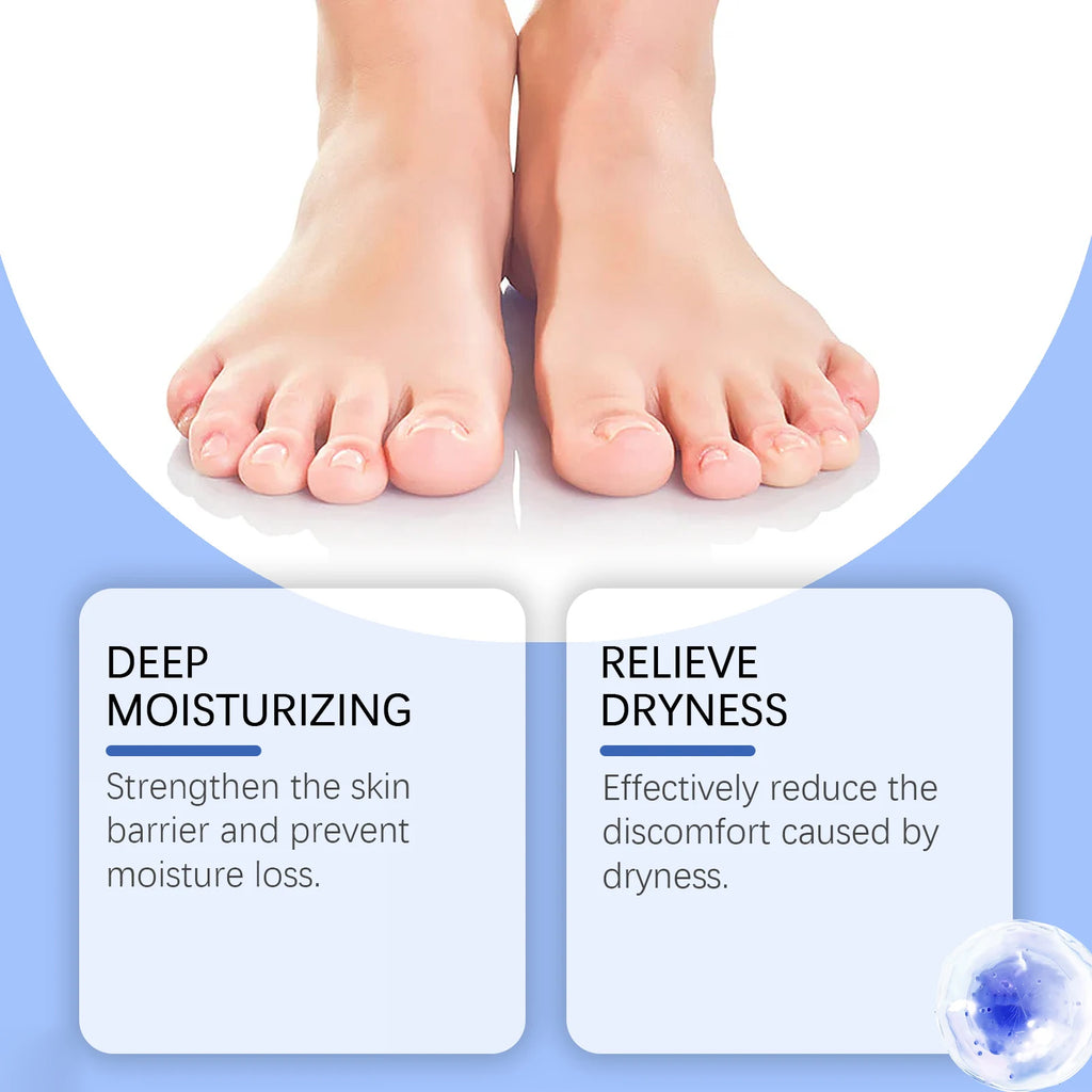 60% Urea Foot Cream – Heel Repair, Moisturizing & Exfoliating Foot Care Cream Qst