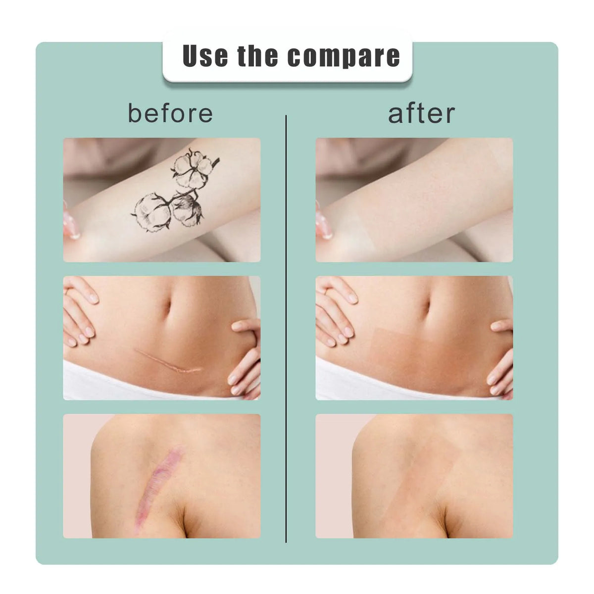 Waterproof Tattoo Cover Up Patches – Breathable Skin Concealer Tattoo Cover Patch Qst