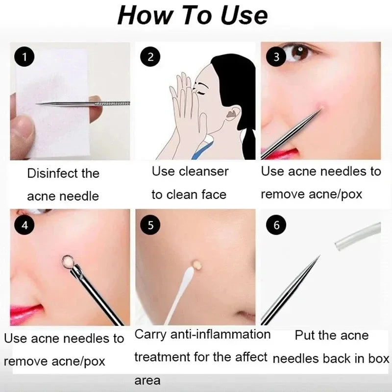 Blackhead Comedone Extractor Tool Set – 4-Piece Pore Cleaner Skin Care Tool Set Qme