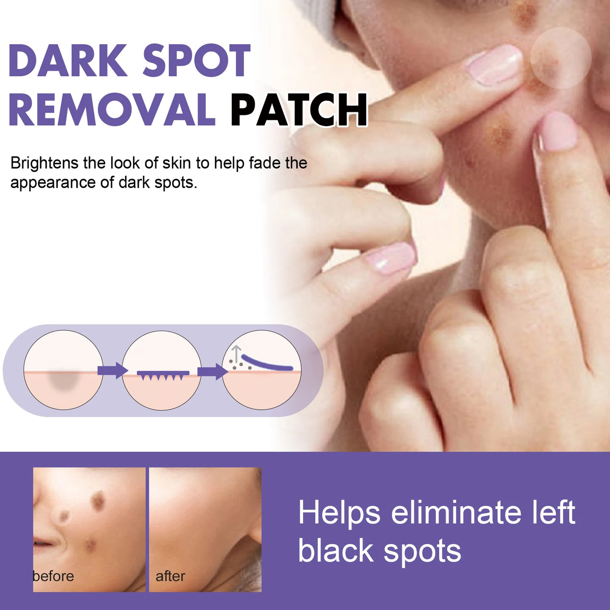 Eelhoe Dark Spot Brightening Patches 144pcs – Overnight Skin Brightening Patch Qst