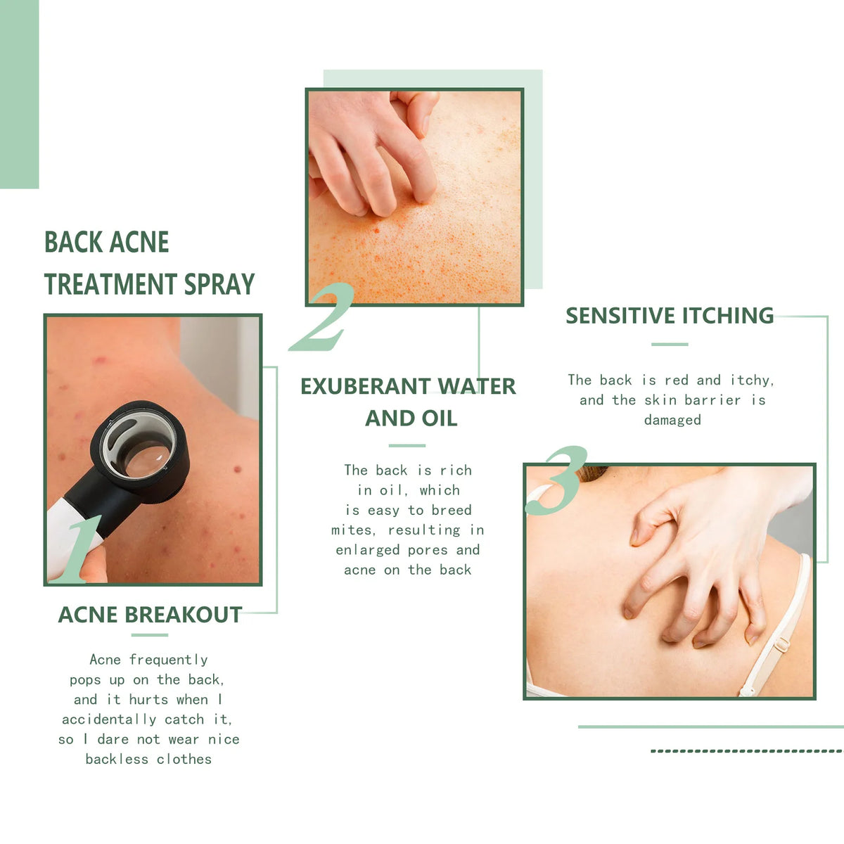 Eelhoe Back & Body Acne Clarifying Spray – 120ml Serum Body Acne Spray Qst