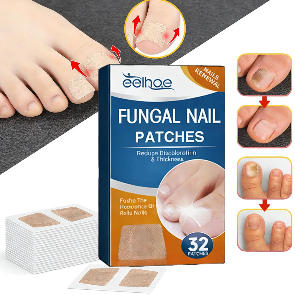 Toenail Correction Patch – Ingrown Nail & Nail Care Bandage Toenail Correction Patch Qst