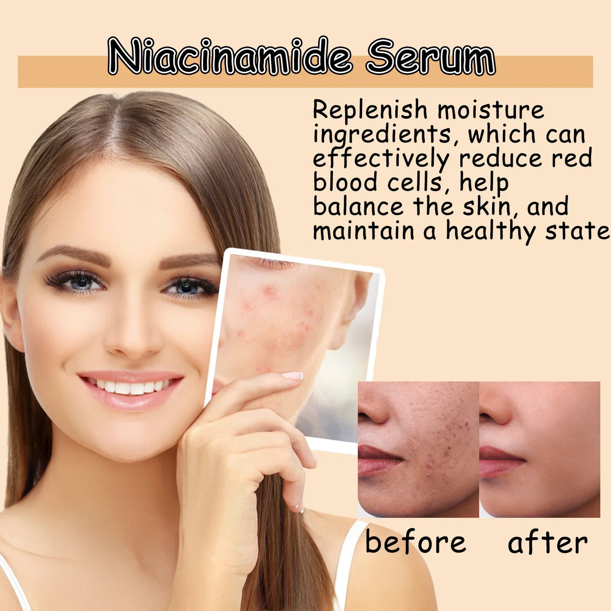 Nicotinamide Face Serum – Brightening & Pore-Smoothing Essence Brightening Face Serum Qme