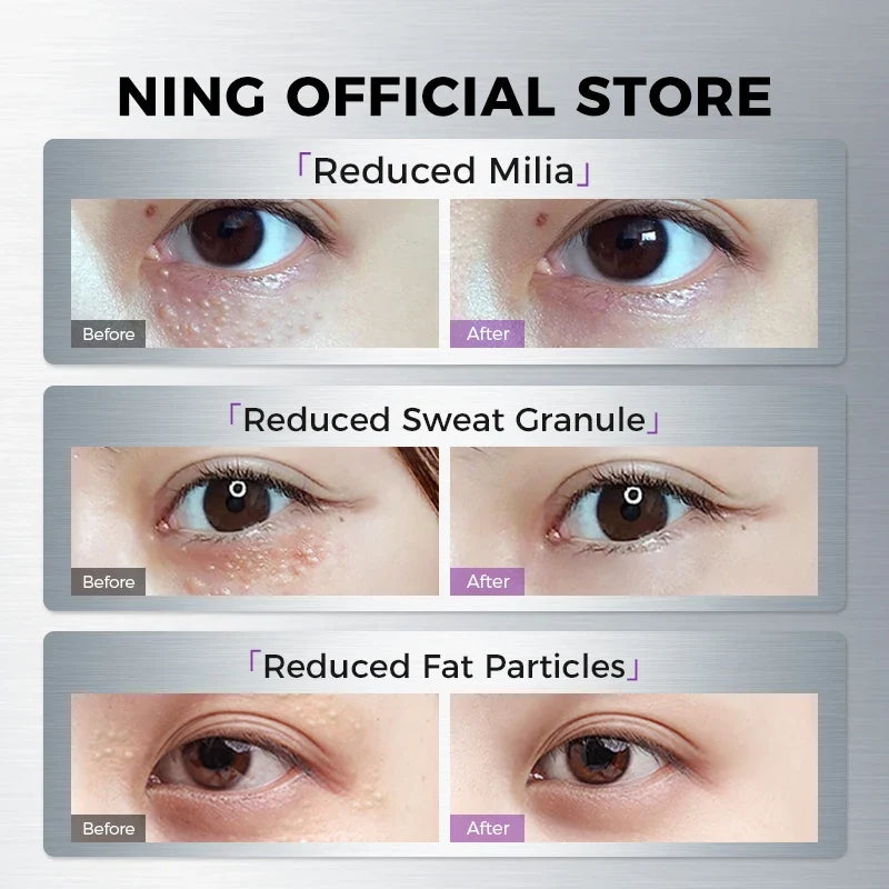 NING Eye Essence – Zinc, Fermented Yeast & Peptides | Qme Eye Lifting Serum Qme
