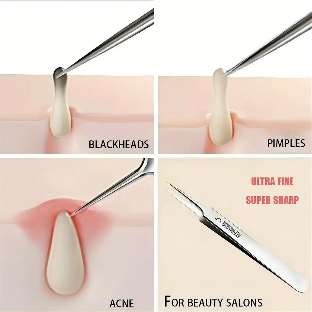 Extra Fine Blackhead Tweezers – Stainless Steel Facial Tool | Qme Facial Tweezers Qme