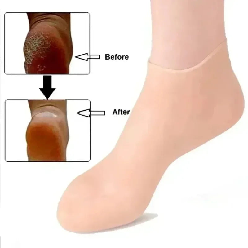 Silicone Moisturizing Gloves & Socks – Hands & Feet Care Set Moisturizing Spa Gloves Qme