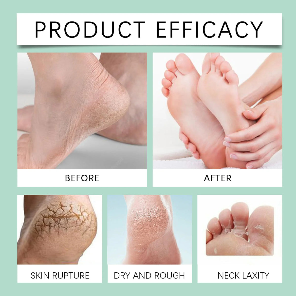OceAura Foot Exfoliating Spray 100ml – Callus Softener Foot Exfoliating Spray Qst