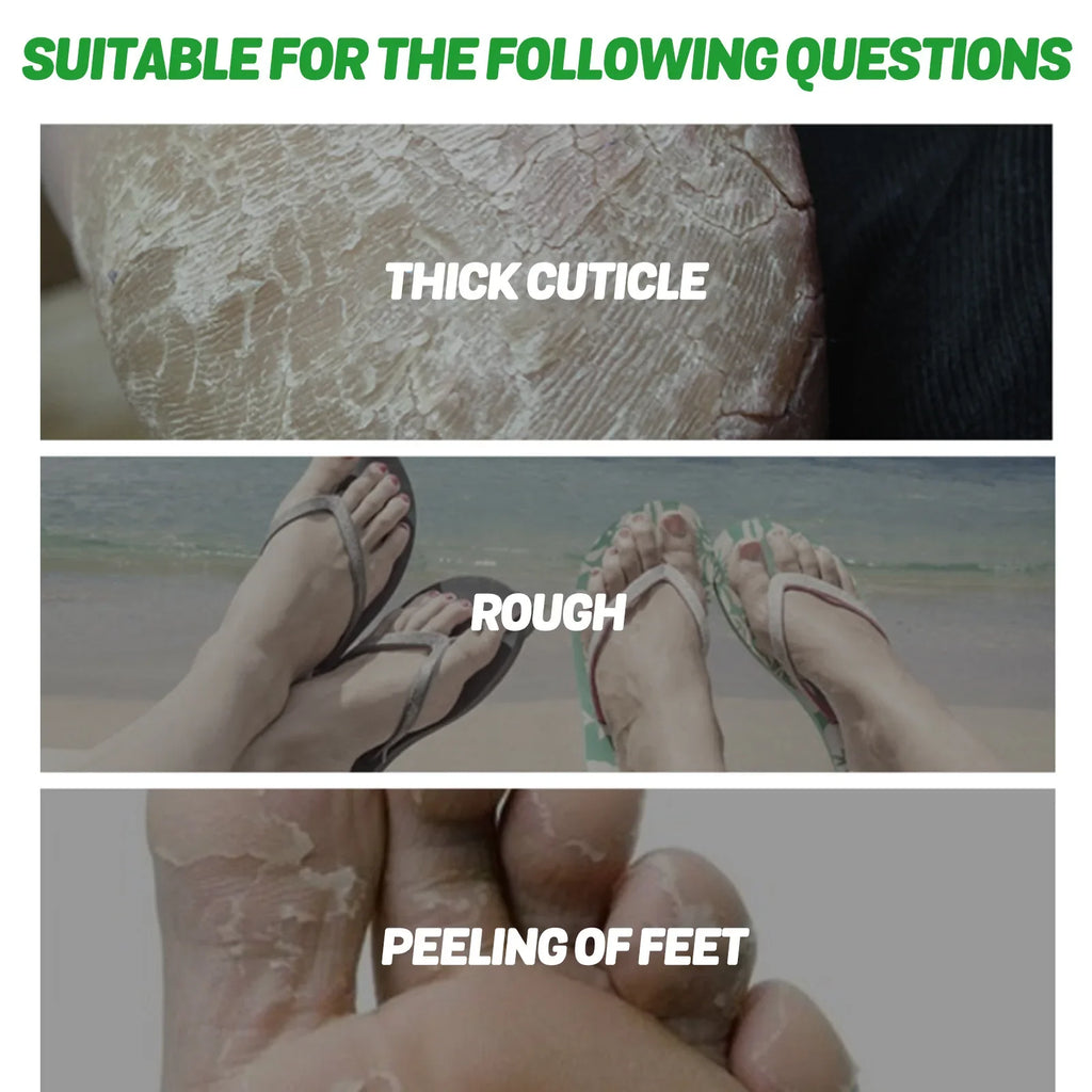 Aloe Vera Foot Mask – Moisturizing Exfoliating Foot Peel Exfoliating Foot Mask Qme