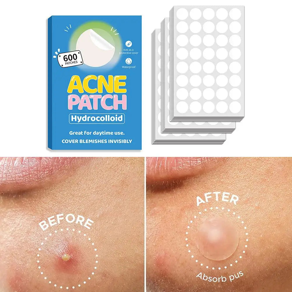 Invisible Hydrocolloid Acne Patches – Blemish Spot Covers Acne Patch Qme