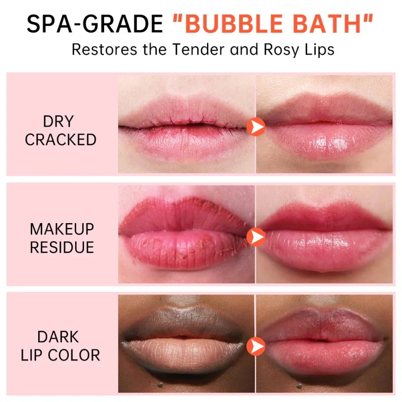 Brightening Lip Mask Balm Serum – Exfoliating Lip Care | Qme Lip Mask Serum Qme