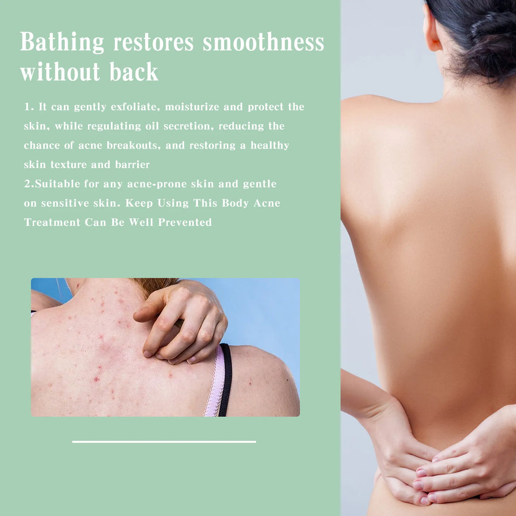 Eelhoe Back & Body Acne Clarifying Spray – 120ml Serum Body Acne Spray Qst