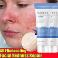 Sensitive Skin Facial Cream – Calming Moisture & Hydration Face Moisturizer Cream Qme 1pc