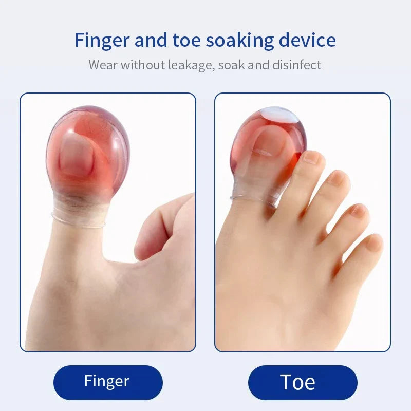 Soft Silicone Toe Sleeves – Friction Guard & Nail Protectors Toe Protector Sleeves Qme