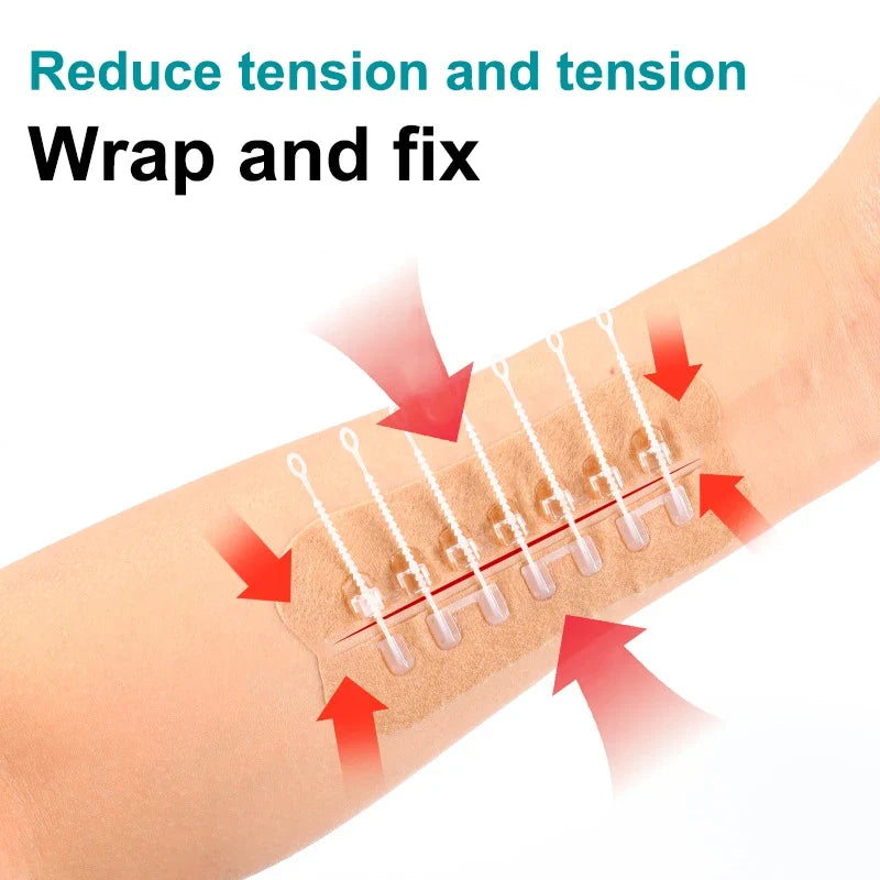Zipper Wound Closure Strips – Sutureless Adhesive Skin Patches Wound Closure Strips Qme