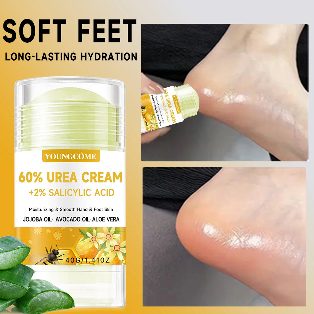 YOUNGCOME 60% Urea + 2% Salicylic Acid Foot Cream & Deodorant Foot Cream & Deodorant Qst