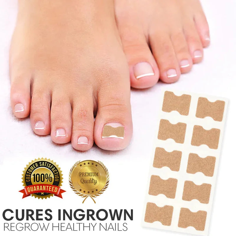 Toenail Correction Strips – Waterproof Pedicure Tool 10/100 Pcs Toenail Correction Strips Qst
