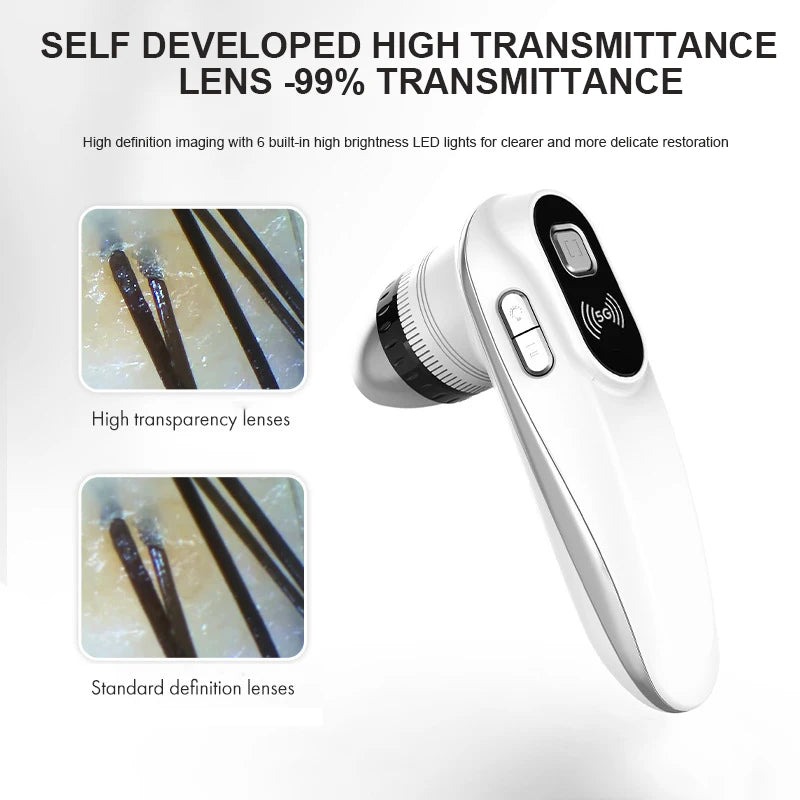 WiFi Scalp & Skin Analyzer 50X/200X UV Hair Follicle Detector Scalp Skin Analyzer Qst