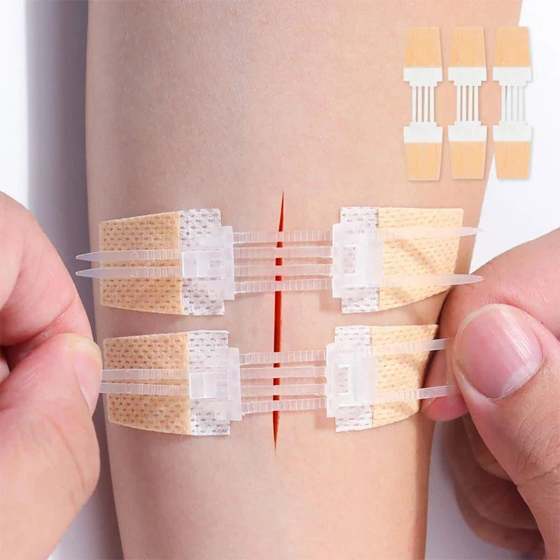 Zipper Wound Closure Patch – Sutureless Waterproof Bandage Wound Closure Patch Qme