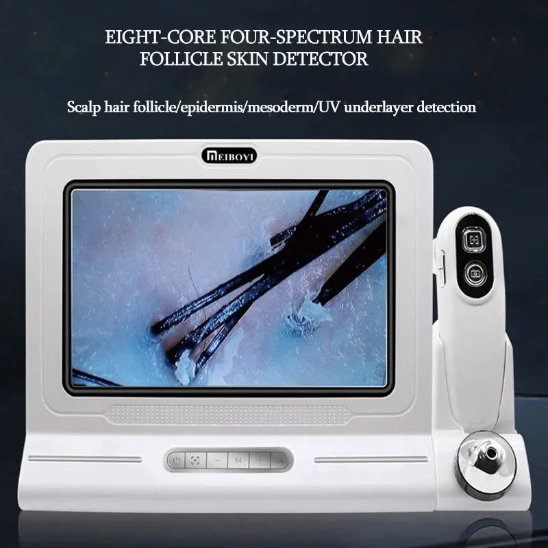 Vilnason 11" Scalp & Skin Analyzer | 50X 200X Dual Lens | 4 Spectrums Scalp Skin Analyzer Qst