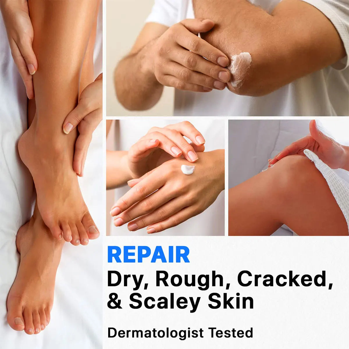 Urea & Salicylic Acid Hand & Foot Cream – Tea Tree & Aloe Hand & Foot Cream Qst