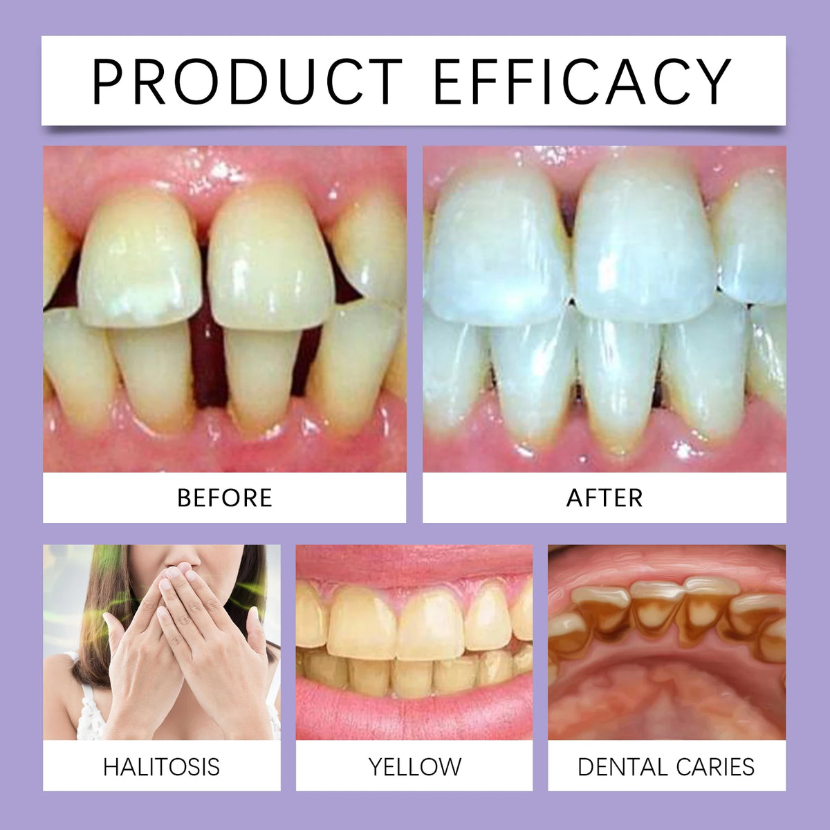 Purple Teeth Brightening Strips – Stain Removing Dental Patches Teeth Brightening Strips Qst