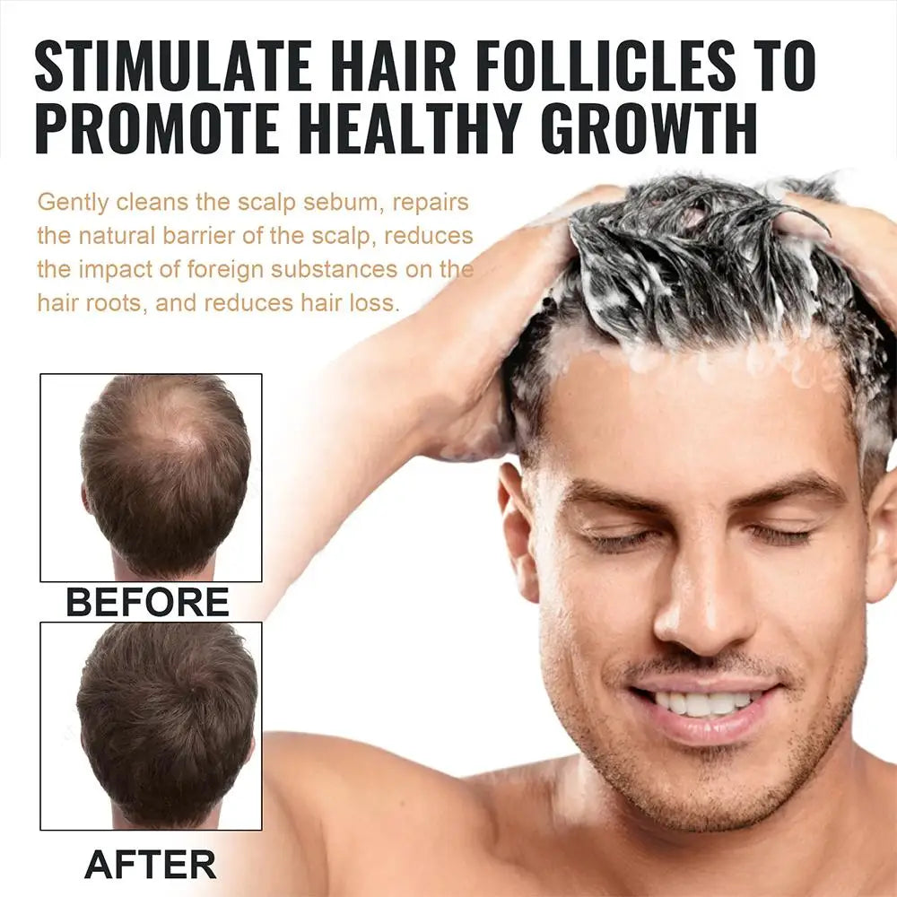 Hair Thickening Root Activator Nourishing Shampoo | Qme Hair Thickening Shampoo Qme