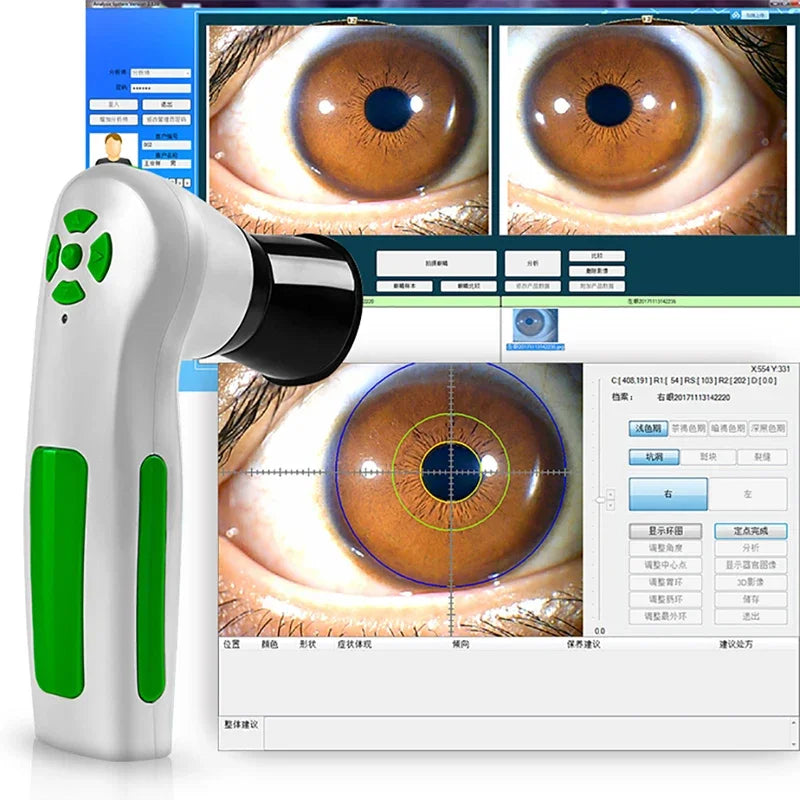 Suyzeko 12MP Digital Iriscope Iris Analyzer Camera & Software Iris Analyzer Camera Qst
