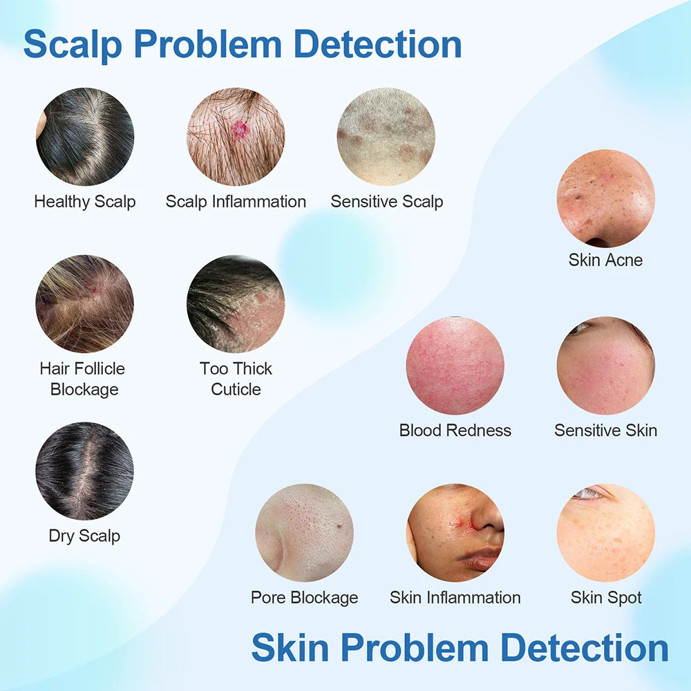 Scalp & Hair Follicle Analyzer – 4X HD Pore Skin Detector Scalp Skin Analyzer Qst