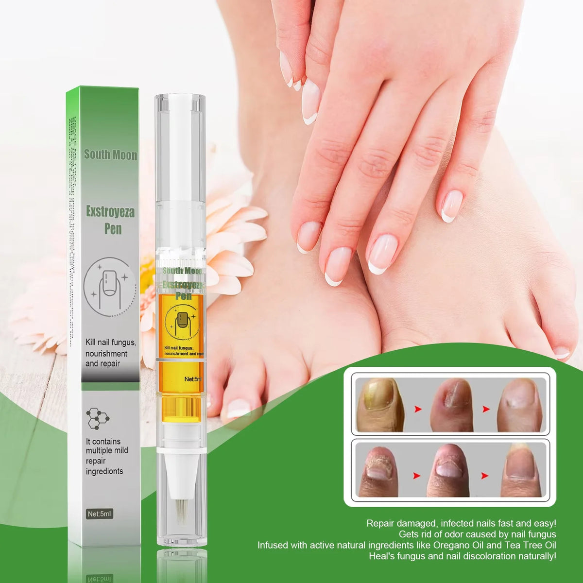 South Moon Nail Repair Pen – Brightening Nail Care Liquid 5ml Nail Care Pen Qst
