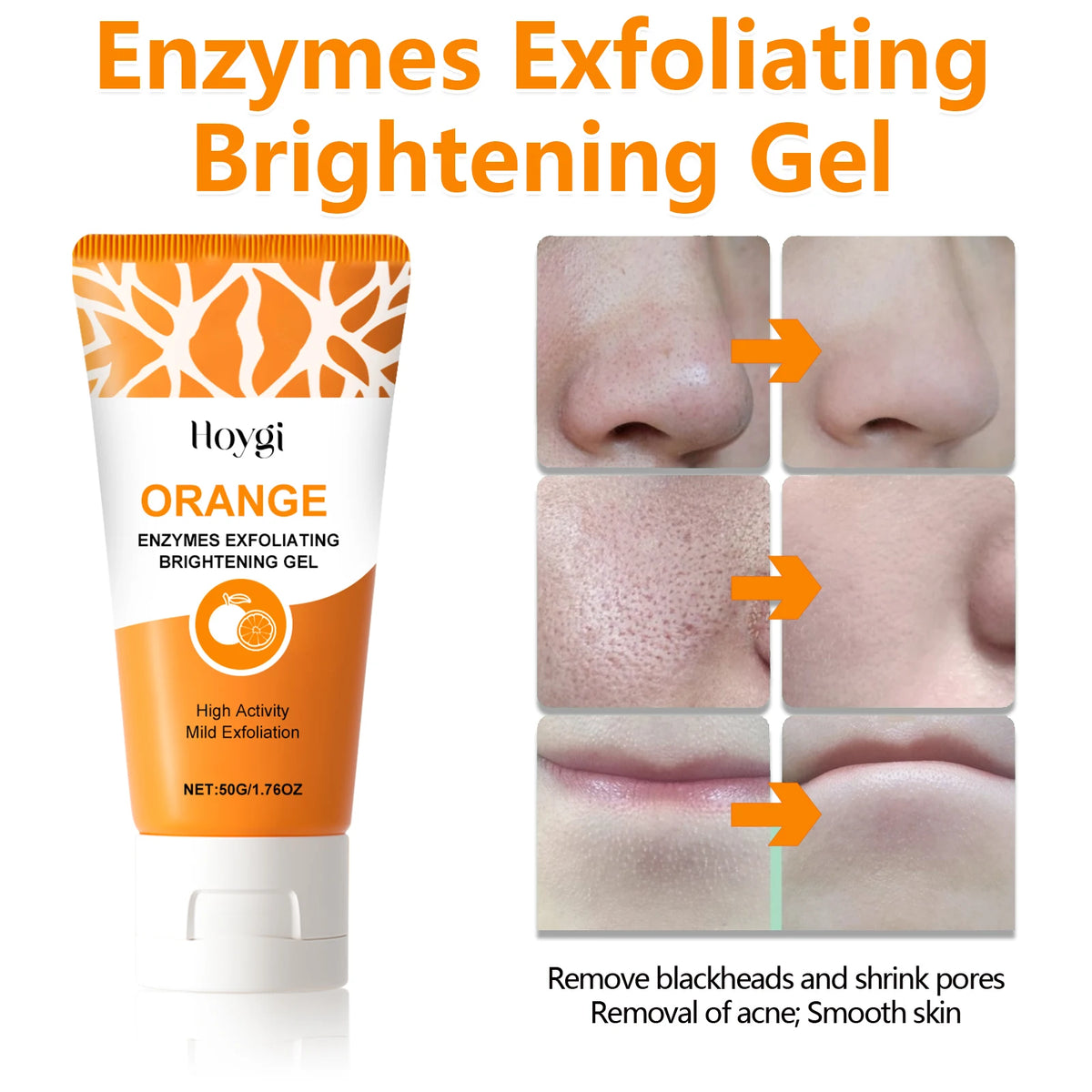 Hoygi Niacinamide Exfoliating Gel – Pore Minimizing Cleanser Exfoliating Face Cleanser Qst