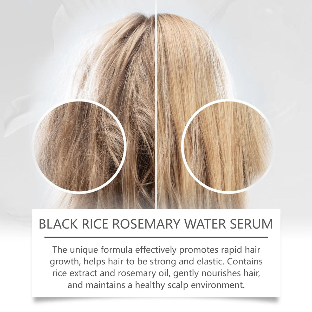 West Month Black Rice Rosemary Hair Growth Serum 30ml Hair Growth Serum Qst