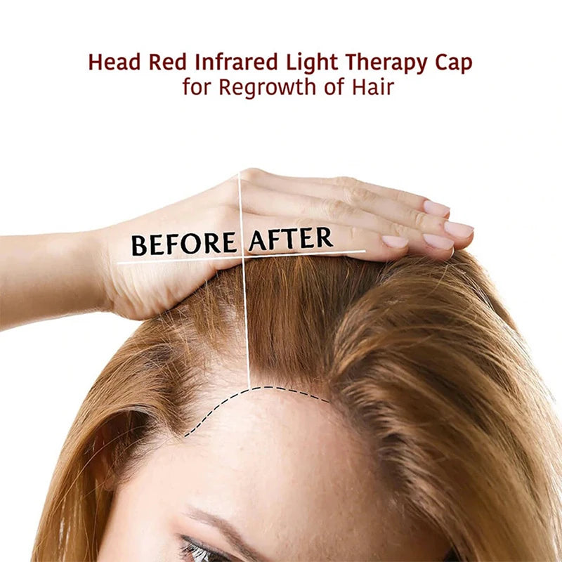 70-LED Red Light Therapy Hair Cap – 660nm & 850nm Growth LED Hair Growth Cap Qst