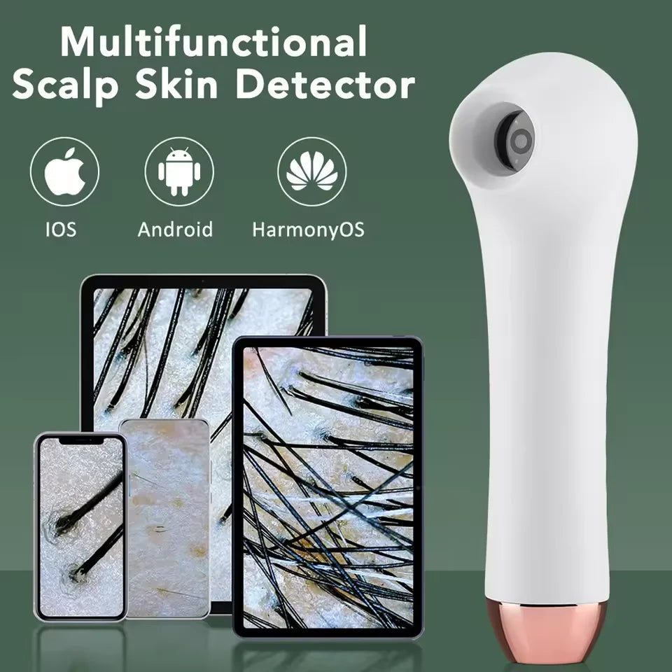 HD Scalp & Hair Follicle Analyzer – WiFi Skin Magnifier Scalp Skin Analyzer Qst