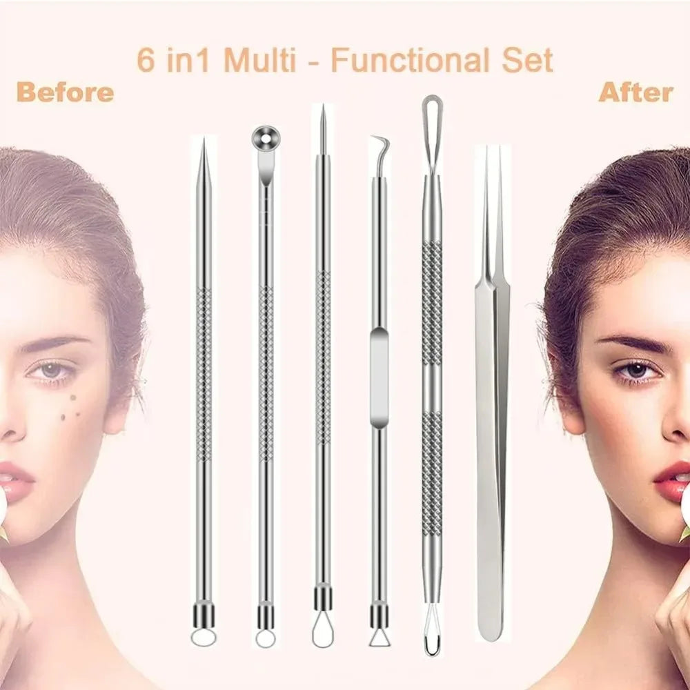 Stainless Steel Comedone Extractor & Blackhead Remover Tool Set Skin Care Tool Set Qme