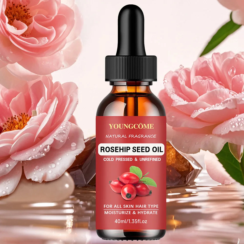 YOUNGCOME Rose Essential Oil – Aromatherapy & Skin Care 40/60ml Essential Oil Qst