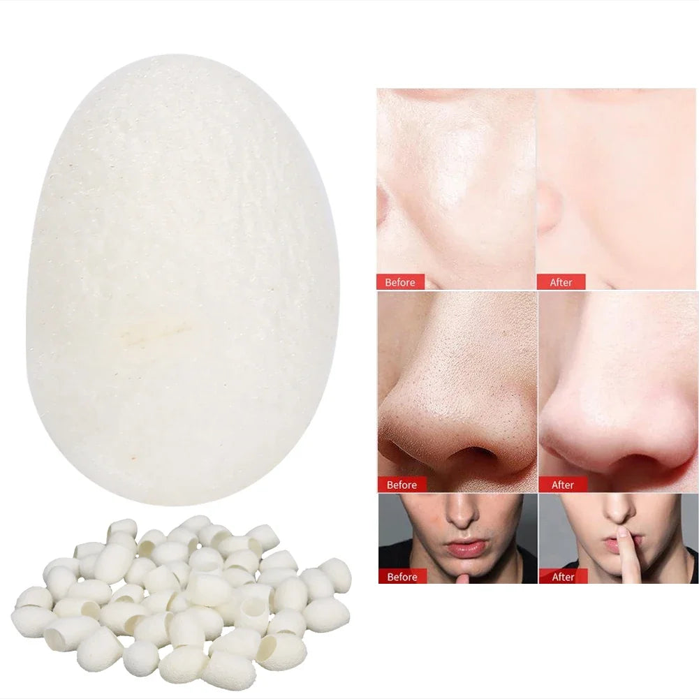 Natural Silk Fibroin Exfoliating Silkworm Balls – Deep Pore Cleanse Facial Exfoliator Qme