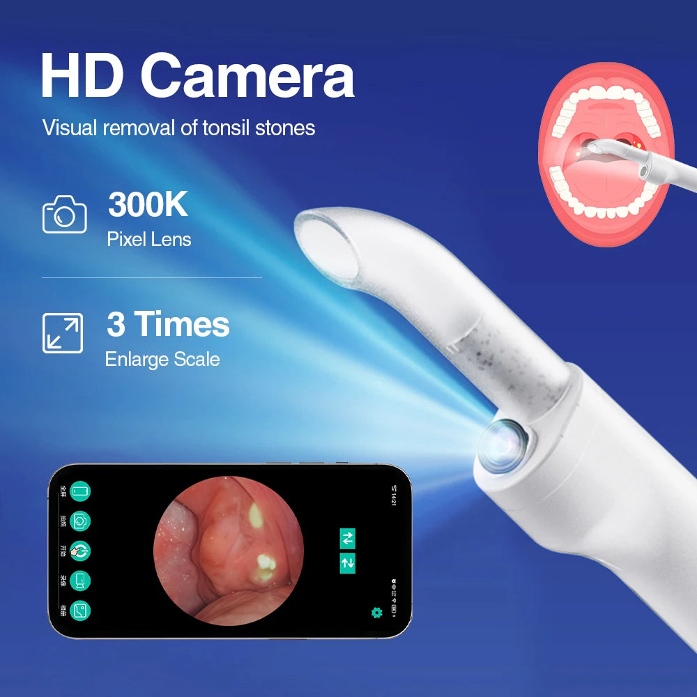 Ms.Dear Electric Tonsil Stone Remover – HD Camera, 3 Suction Levels Oral Care Device Qst