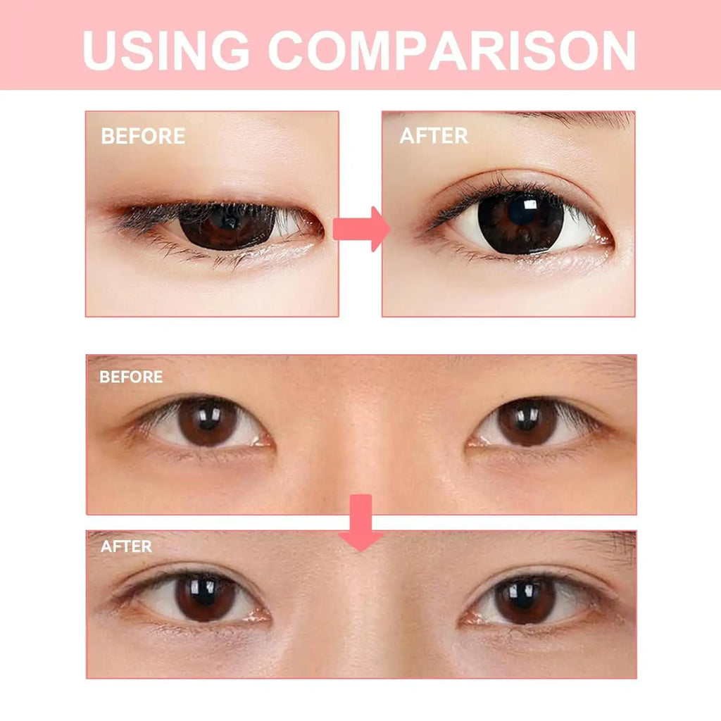 Invisible Double Eyelid Shaping Cream – Waterproof | Qme Eyelid Shaping Cream Qme