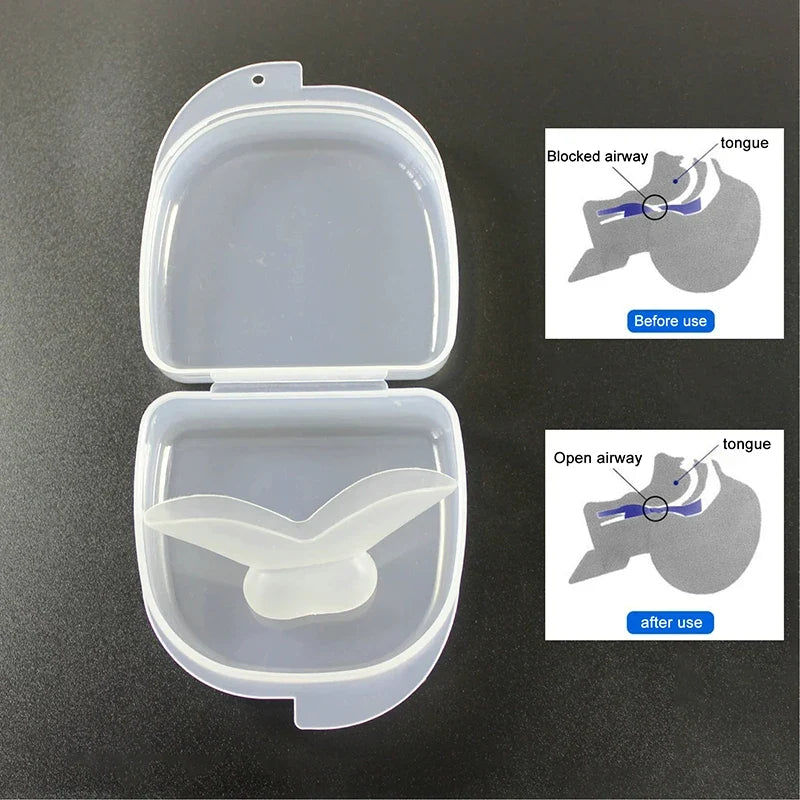 Silicone Anti-Snoring Tongue Mouthpiece Sleep Guard Device Sleep Mouthpiece Guard Qme